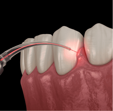 Routine Dental Care